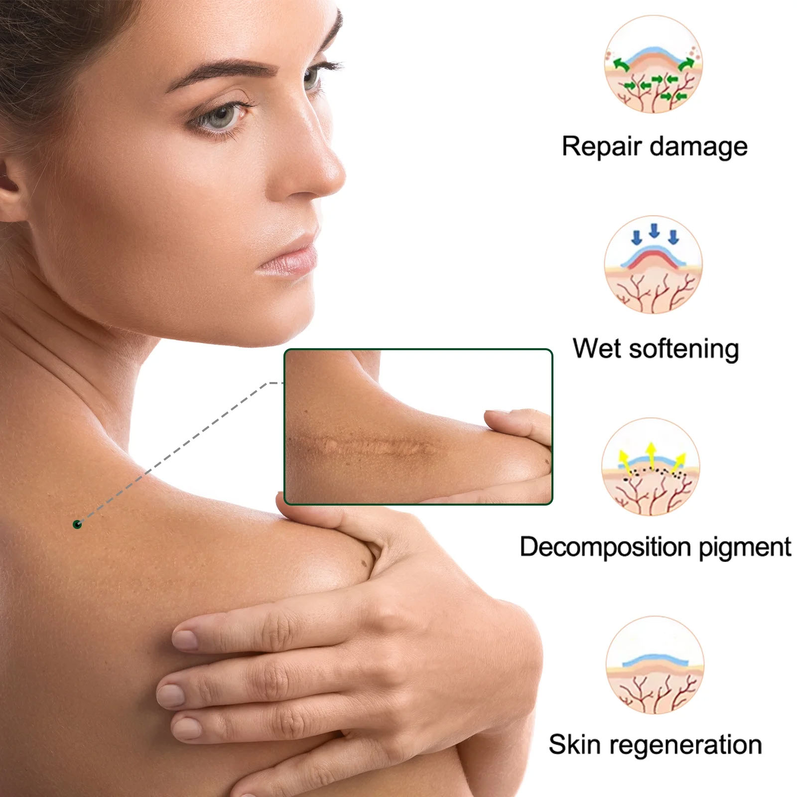 Silicone Scar Sheet - Image 5