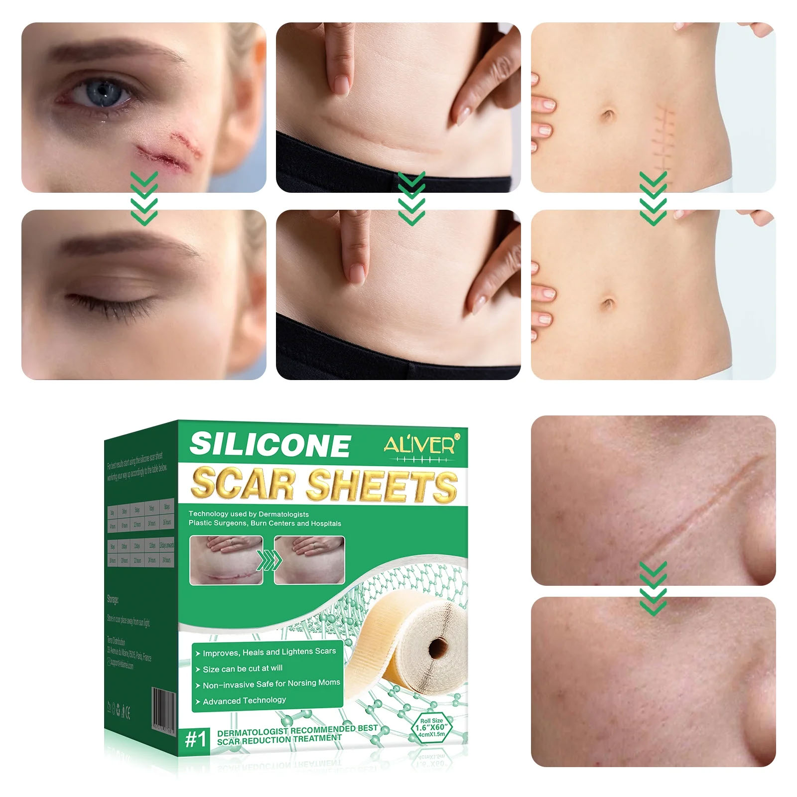 Silicone Scar Sheet - Image 6