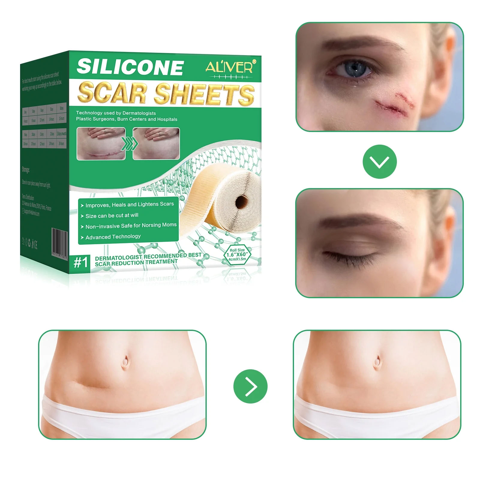Silicone Scar Sheet - Image 7