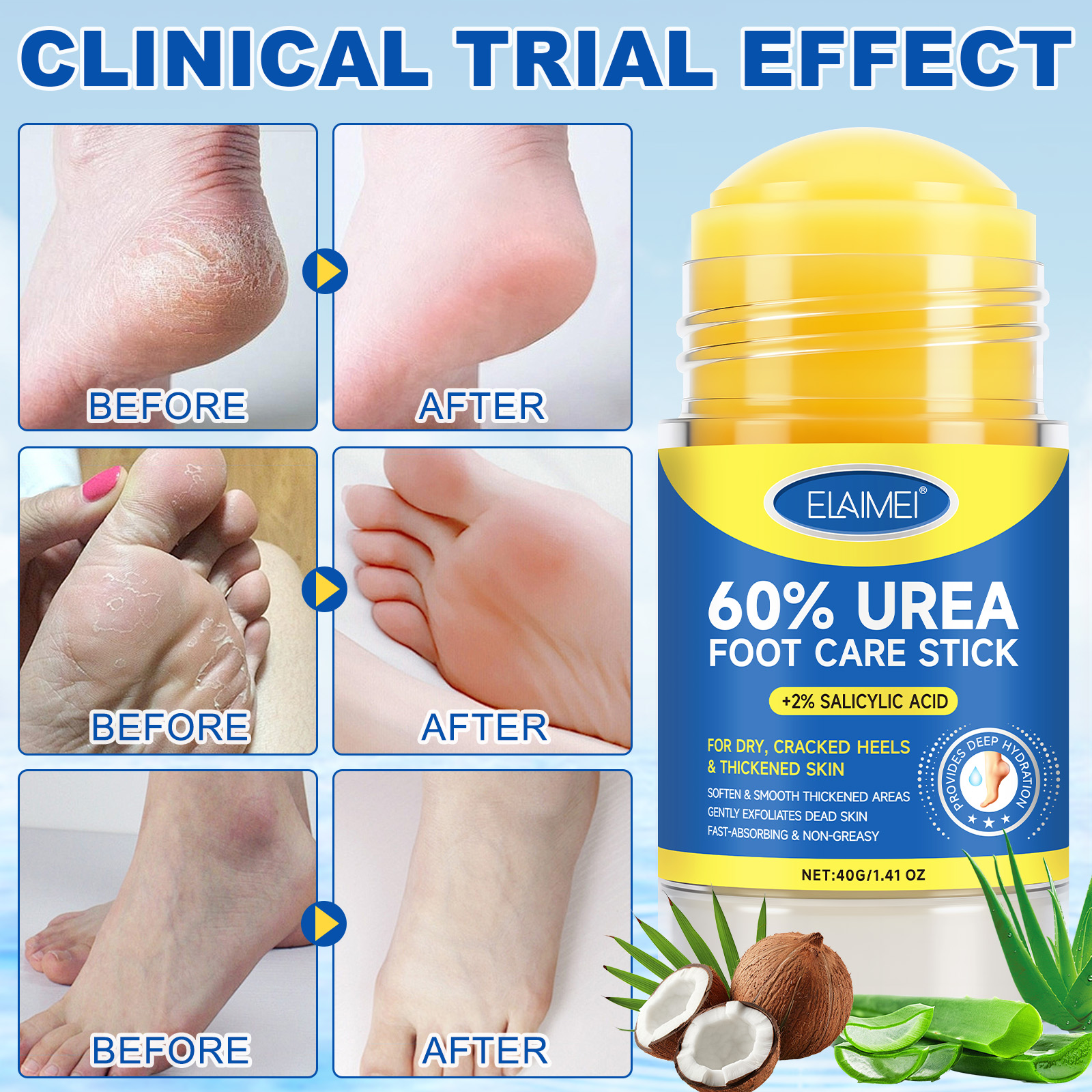 Foot Care Balm Stick 60% Urea Cream with Aloe Vera - Image 3